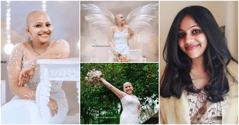 Cancer Survivor Steffy Thomas Wedding Photoshoot Goes Viral Entertainment News Malayalam